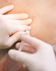 superior/inferior hypogastric plexus injections | Comprehensive Pain Management Center