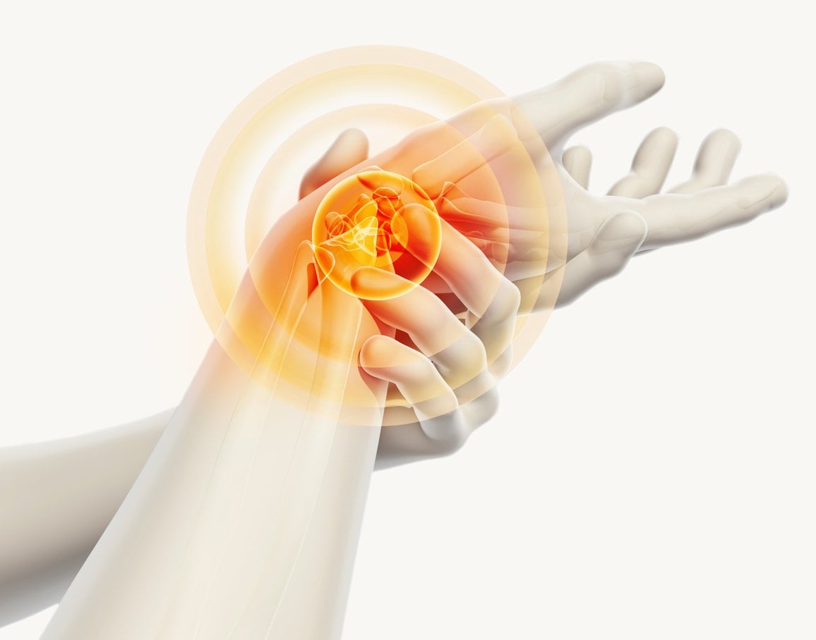 How an Arthritis Treatment Center Can Help With Your Pain CPMC