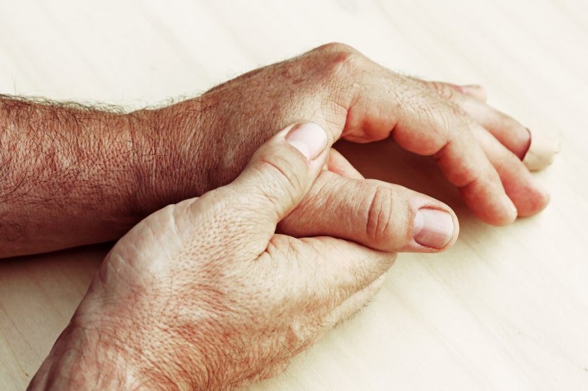 What Is Migratory Arthritis